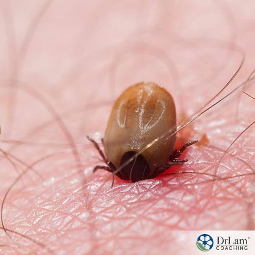 Regain your health with natural Lyme disease cures