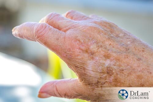 A hand with aged skin that can benefit from colostrum