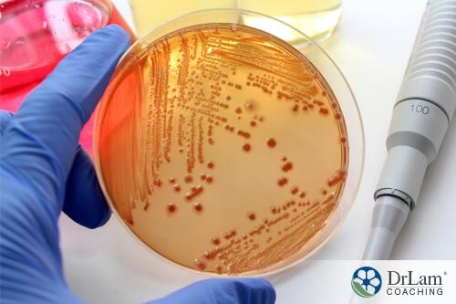 Petri dish of bacteria from tainted meat being held by scientist hand