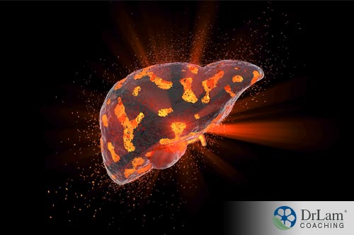 An image of a damaged liver possibly from excess iron