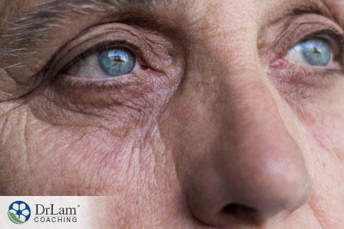 A closeup image of an older woman face showing her wrinkels and creases around her eyes