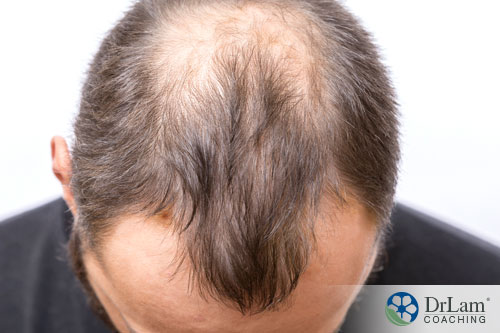 The Truth About Androgen Replacement Therapy, Hair Loss, and Stress