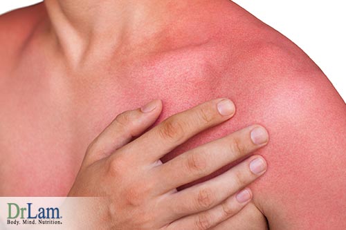 Not only is consuming coconut oil good for you, applying it on your sunburn can help as well.