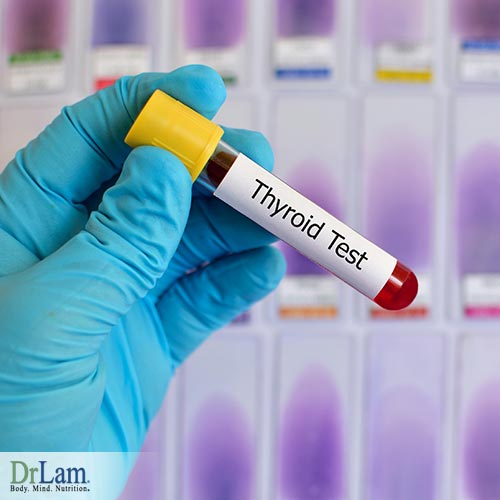 Thyroid gland function testing 