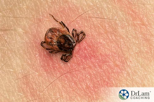 Food and natural Lyme disease cures