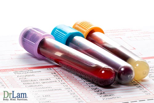 Stress induced inflammation and blood testing