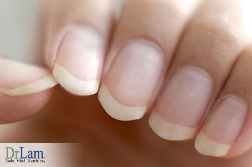 Healthy vs unhealthy fingernails