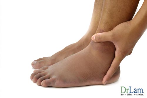 About hormonal imbalance and ankle swelling