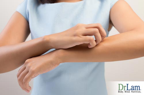 Hypersensitivity symptoms can include itchy skin