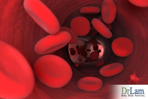 Excess iron may damage important blood vessels