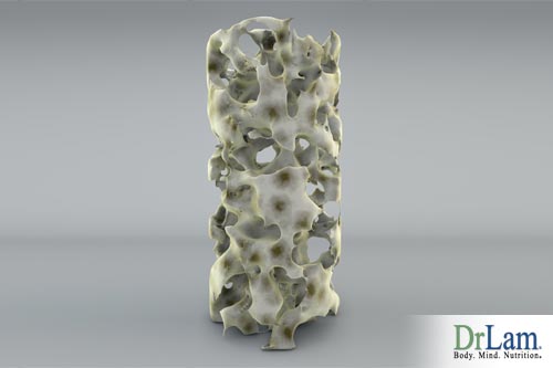 Osteoporosis affects bone density, can strontium for osteoporosis be the key