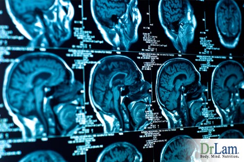 Brain Imaging and Conventional Medicine
