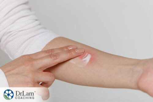 An image of a woman applying cream on her contact dermatitis