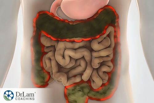 An image of the intestines