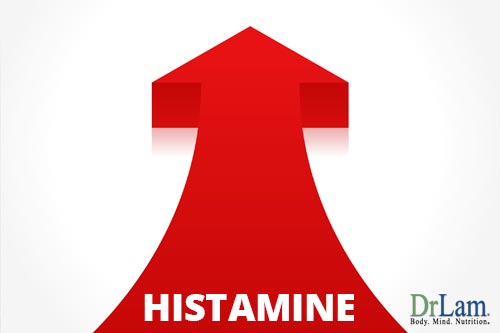 Elevated Histamines