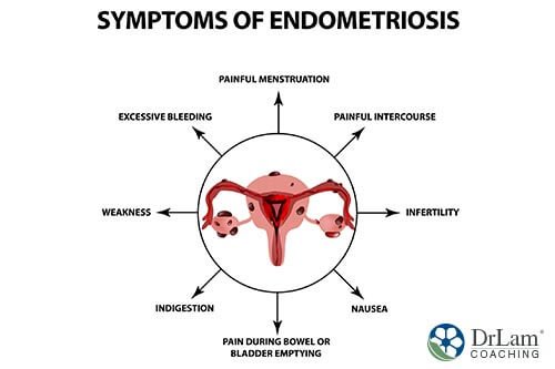 A drawing of a uterus with the symptoms of endometriosis around it
