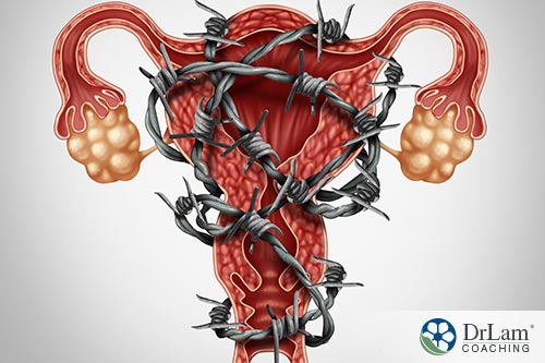 An image of a uterus with barbed wire all around it
