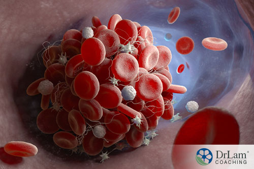 An image of a blood clot