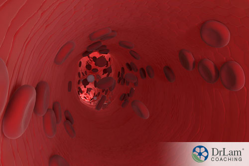An image of blood platelets adhearing to the walls