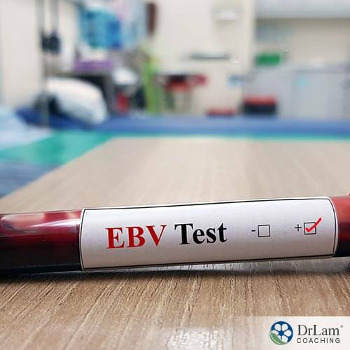 An image of a vial of blood with EBV test on the label