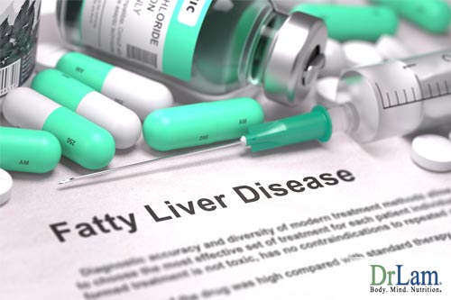 Is fatty liver among the list of what causes fatigue?