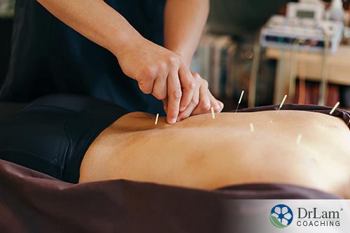 An image of a man in a spa having acupuncture