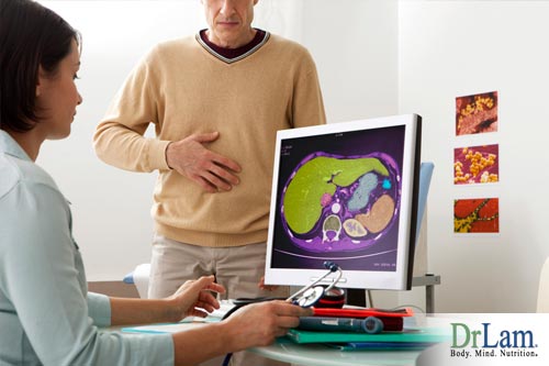 A health professional looking at a medical image of a patient’s liver while the patient has his hand over his abdomen and looks worried about how to cleanse the liver and possible liver problems.