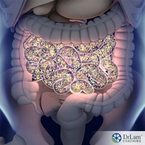 An image of the small intestines showing the effects of immigration and gut microbiome