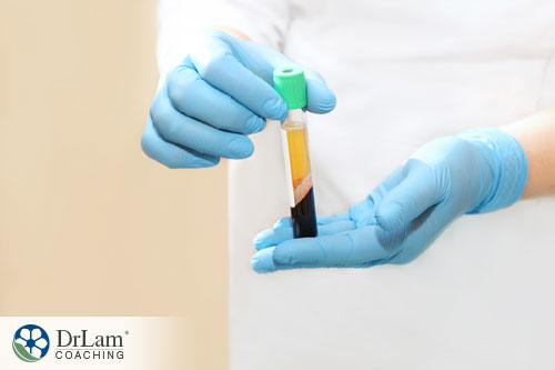 An image of a test tube with platelet rich plasma inside