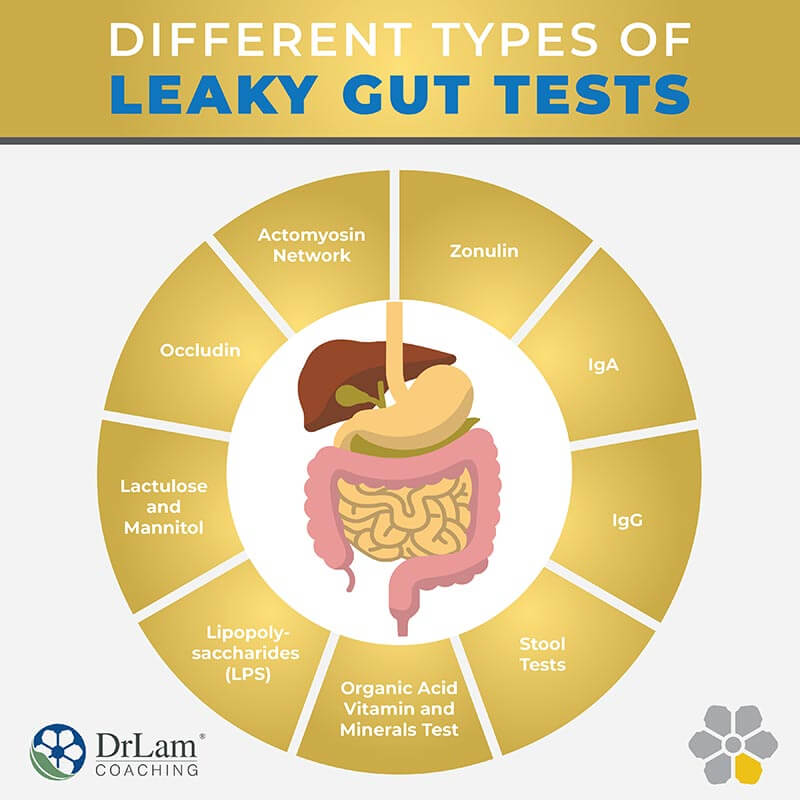 Check out this easy to understand infographic about different types of leaky gut tests