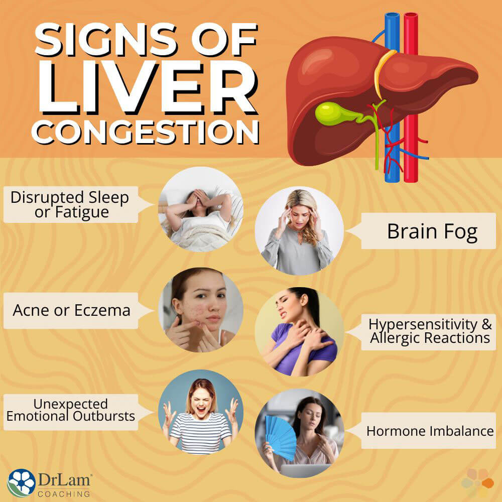 Signs of Liver Congestio