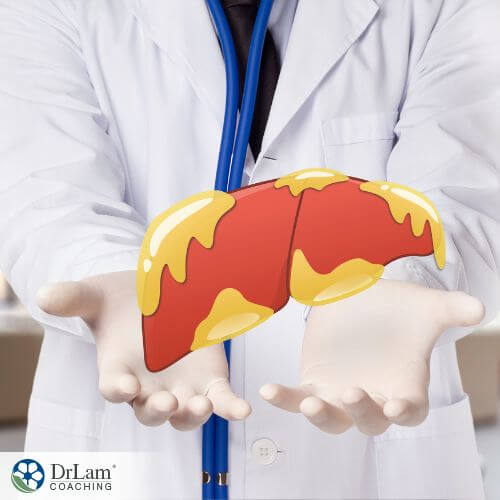 An image of a Ddoctor holding illustrated fatty liver in hospital setting