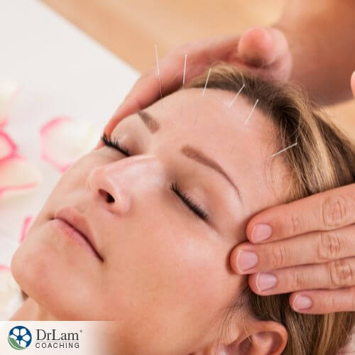 An image of a woman getting acupuncture therapy