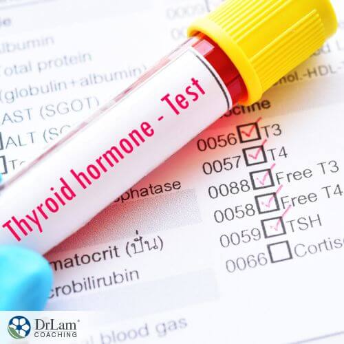 An image of a thyroid test tube
