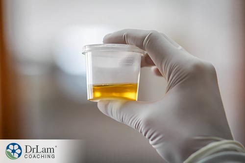 An image of a urine sample