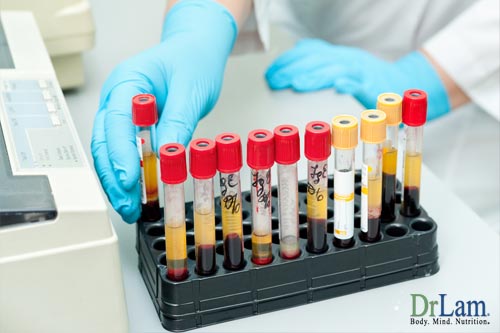 Laboratory testing is common when diagnosing Adrenal Fatigue