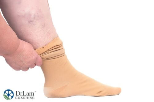 An image of a person putting compression stockings on