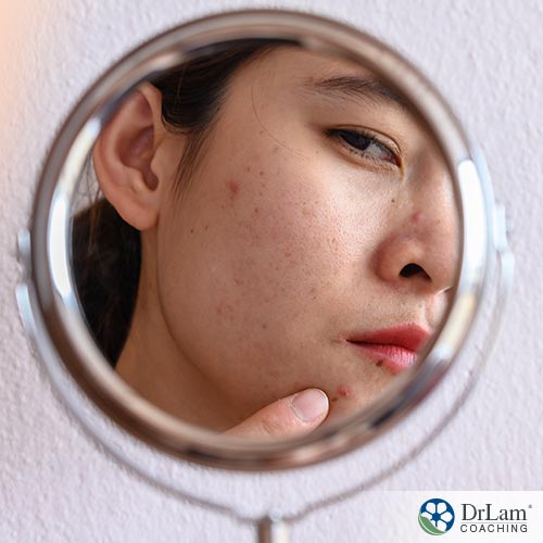 An image of a woman looking in a mirror at the acne on her face