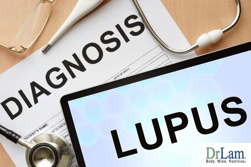 Autoimmune disease supplements and Lupus