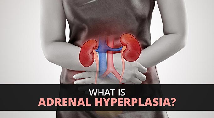 adrenal hyperplasia