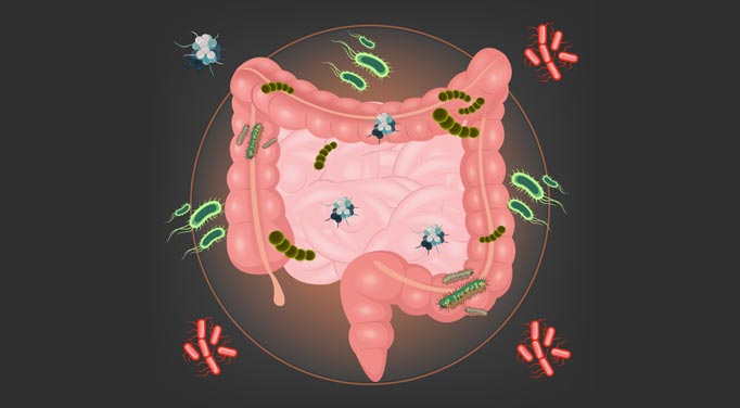 Healthy gut bacteria