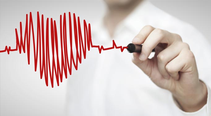 Listen to your heart's lone atrial fibrillation. Is it regular?