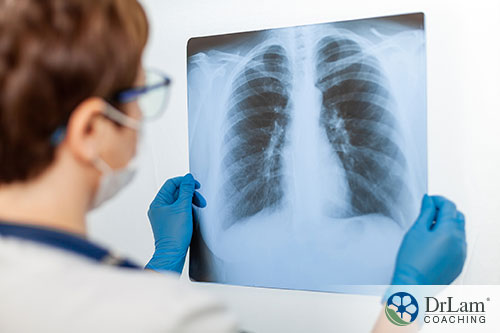 An image of a doctor examining an x-ray image of lungs