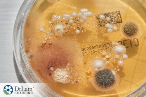 An image of a petri dish with various things growing in it