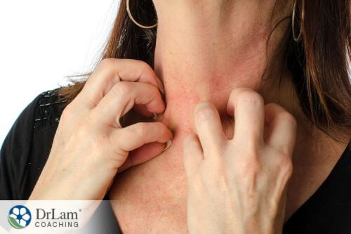 An image of a woman itching her inflamed neck