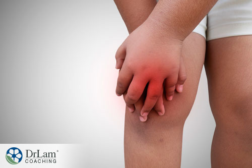 An image of an inflamed knee