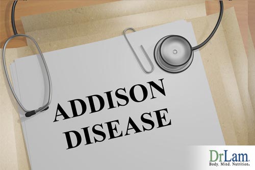 When figuring out how to treat adrenal fatigue, it is important to rule out similar conditions like Addison’s Disease