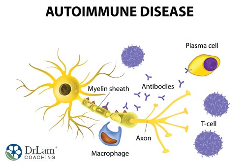 An image of a molecular view of an autoimmune disease