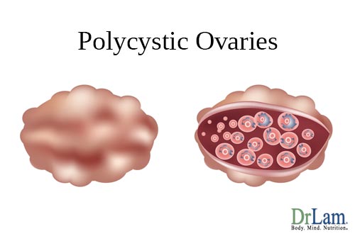 Ovaries, vitex and PCOS