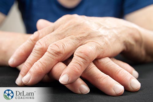 An image of arthritic hands